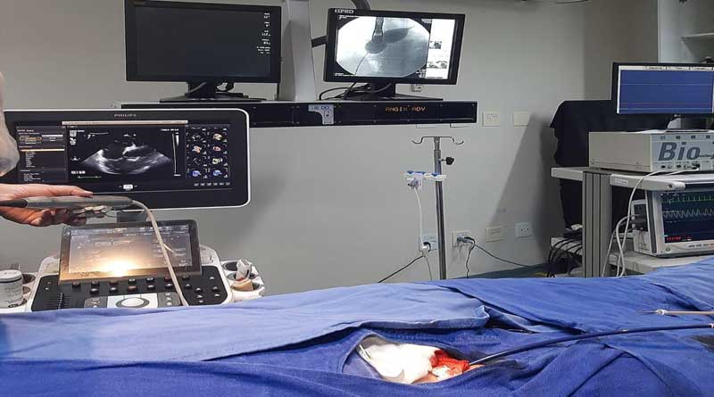 prontocor-dispoe-de-tecnologia-de-ponta-para-cirurgia-de-correcao-de-fechamento-do-forame-oval-no-pos-parto